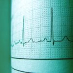 ¿Cuál es el Precio de un Electrocardiograma en Colombia? (2023)