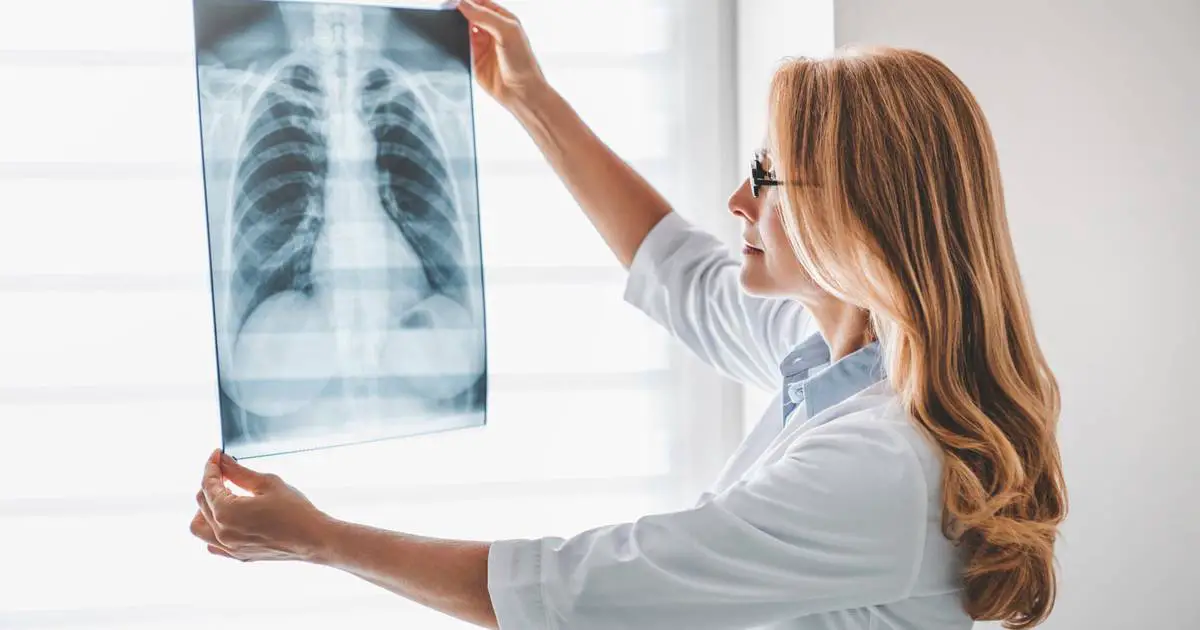 ¿Cuál es el Precio de una Radiografía en Colombia? (2023)